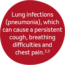 Lung infections (pneumonia), which can cause a persistent cough, breathing difficulties and chest pain.