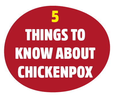 5 things to know about chickenpox. Download and share our 5 must-know facts about chickenpox.