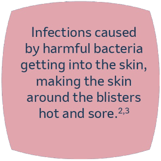 Infections caused by harmful bacteria getting into the skin, making hte skin around hte blidters hot and sore.2,3